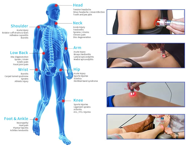 Laser Therapy Machine